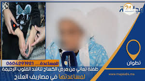 بالفيديو..طفلة تعاني من مرض الكساح تناشد القلوب الرحيمة لمساعدتها في مصاريف العلاج