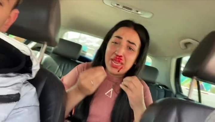 ندى حاسي تتعرض لإعتداء شنيع بأكادير