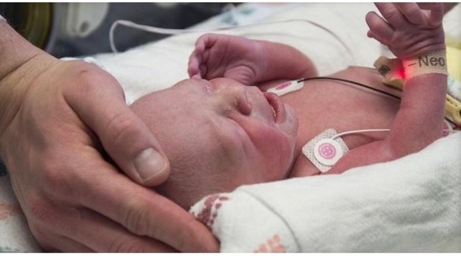 أرجنتينية تتعافى من السيدا وتنجب طفلا سليما