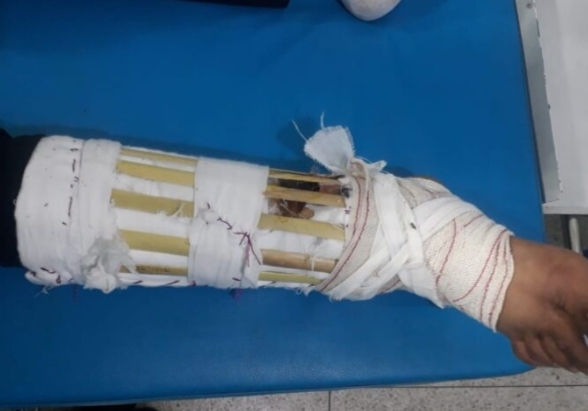 جبار كاد أن يتسبب في بتر ساق شاب كان قد تعرض لحادثة سير