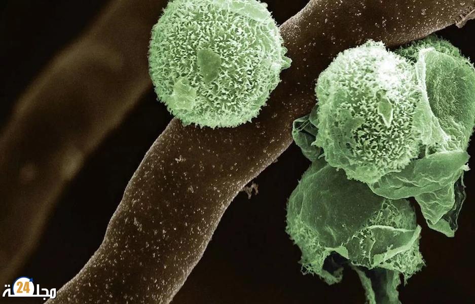 الهند: تسجيل أول إصابة مؤكدة بـ”الفطر الأخضر”