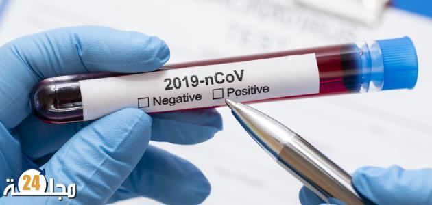 نتائج اختبار كورونا في صفوف الأسود كلها سلبية