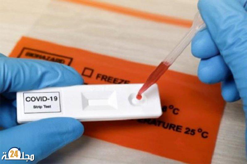 الاختبارات السريعة لكوفيد-19 تعود مجددا إلى الصيدليات