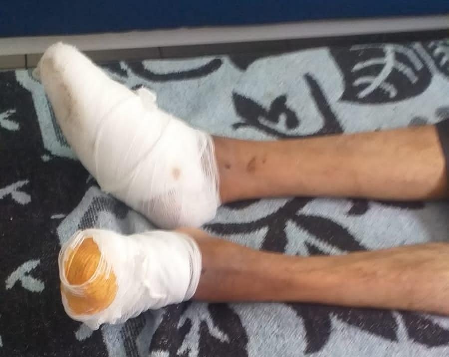 العيون…. مريض يعاني الامرين و المسؤول غائب