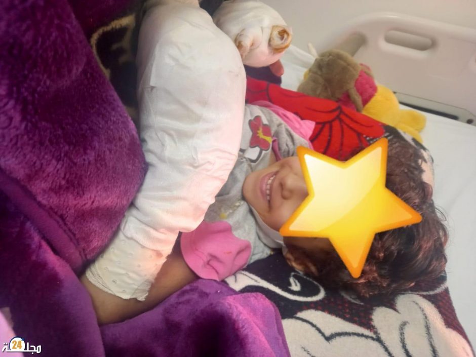سطات..متابعة الجدة المشتبه تورطها في تعريض حفيدتها ” لينا” لحروق في حالة سراح