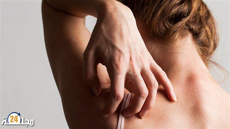 عارض جديد يؤكد الإصابة بأوميكرون