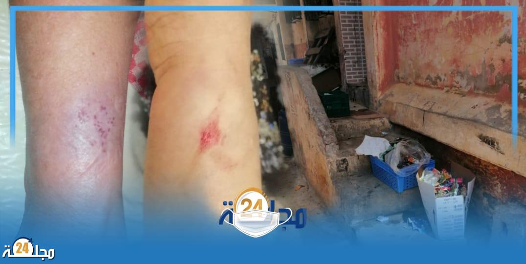 تطوان …مول الحانوت يعتدي على سيدة مسنة ويرسلها المستعجلات