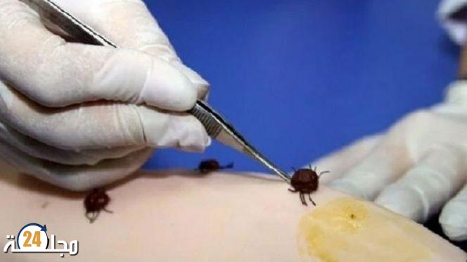 تسجيل حالة وفاة بحمى القرم النزفية بموريتانيا