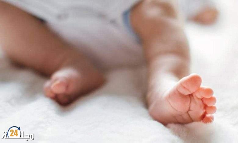 بالصور: وفاة رضيع ولد بعين واحدة في اليمن