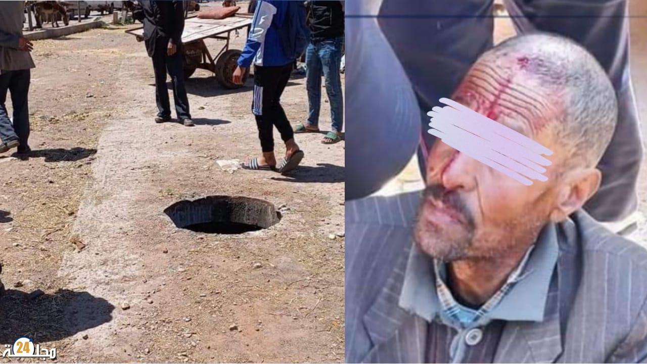 سقوط رجل في بالوعة غير مغطاة “بالواد لصرف الصحي”
