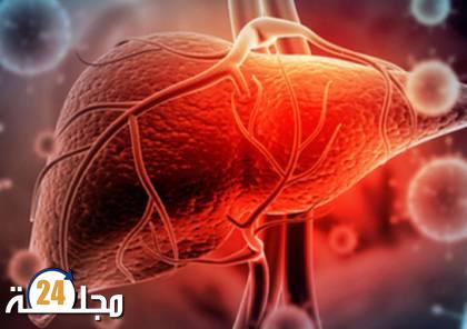 انتشار التهاب الكبد الحاد الوخيم « المجهول المنشأ » في دول أوروبية!