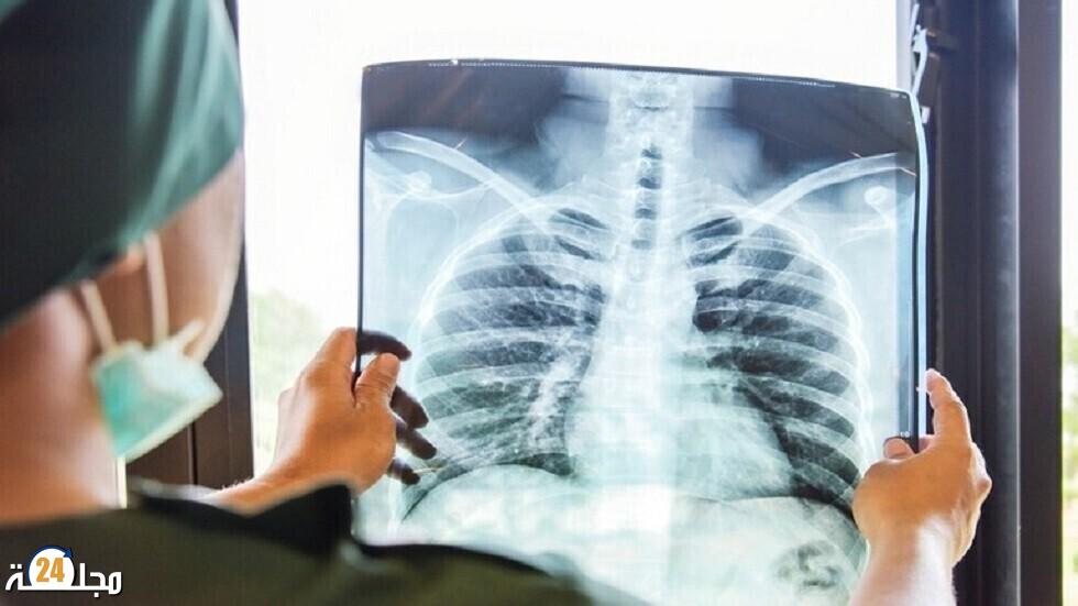 لماذا لا يصاب العديد من « المدخنين مدى الحياة » بسرطان الرئة؟
