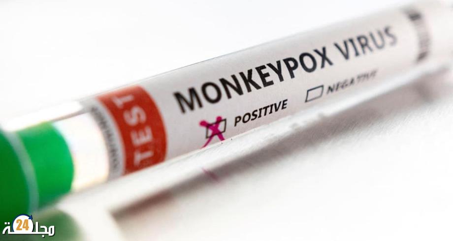 شركة أدوية تطور فحوص PCR لكشف الإصابة عن فيروس جدري القردة