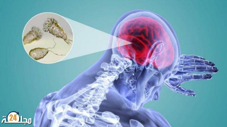 آكلة الدماغ.. أكثر الطفيليات خطورة على الإنسان