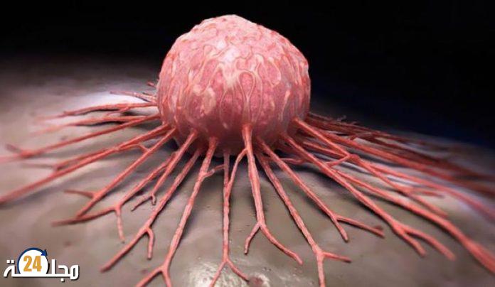 طبيب يدحض أوهاما شائعة عن السرطان