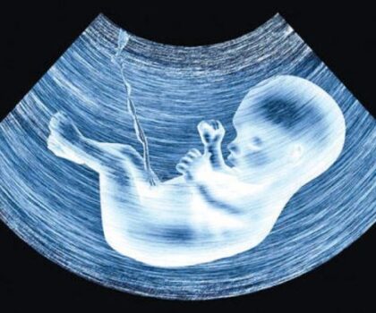 تقنية جديدة للكشف عن الأمراض الخلقية لدى الأجنة