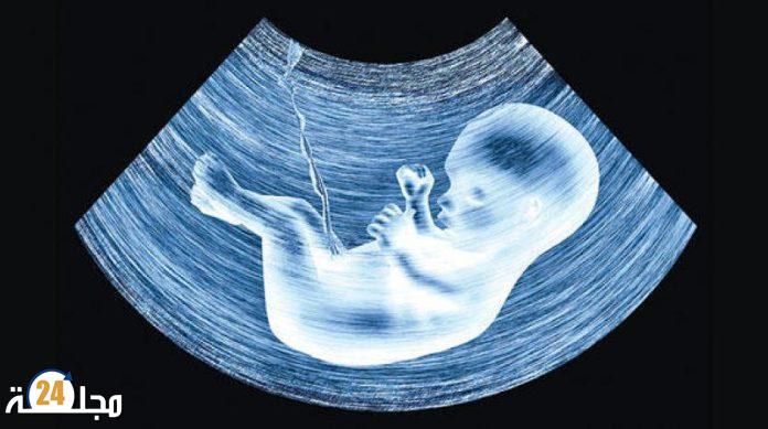 تقنية جديدة للكشف عن الأمراض الخلقية لدى الأجنة