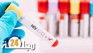 الكشف عن حالة شفاء جديدة من مرض الإيدز