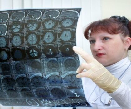 علامات قد تنذر بقرب الجلطة الدماغية