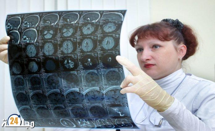 علامات قد تنذر بقرب الجلطة الدماغية