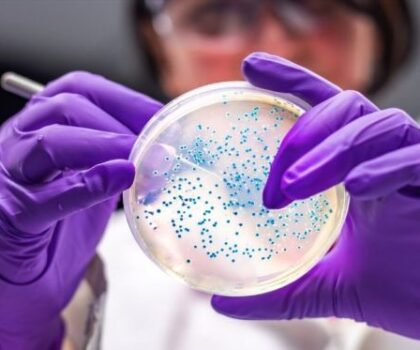 بسبب السالمونيلا.. عملاق الشوكولاتا العالمي يغلق أهم مصانعه