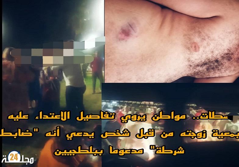 سطات.. مواطن يروي تفاصيل الاعتداء عليه بمعية زوجته من قبل شخص يدعي أنه “ضابط شرطة” مدعوما ببلطجيين