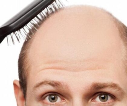 خبراء.. تغير المناخ يسبب الصلع!