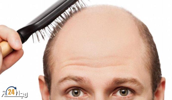 خبراء.. تغير المناخ يسبب الصلع!