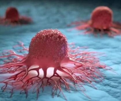 نقص فيتامين محدد قد يرتبط بمرض السرطان!