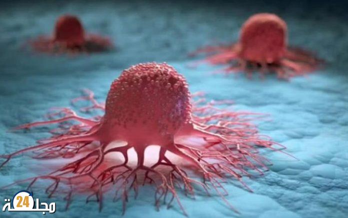 نقص فيتامين محدد قد يرتبط بمرض السرطان!