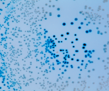 “فيروسات عملاقة” يمكن أن تساعدنا في محاربة مقاومة المضادات الحيوية!