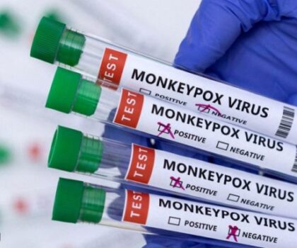 تسجيل أول وفاة بجدري القردة