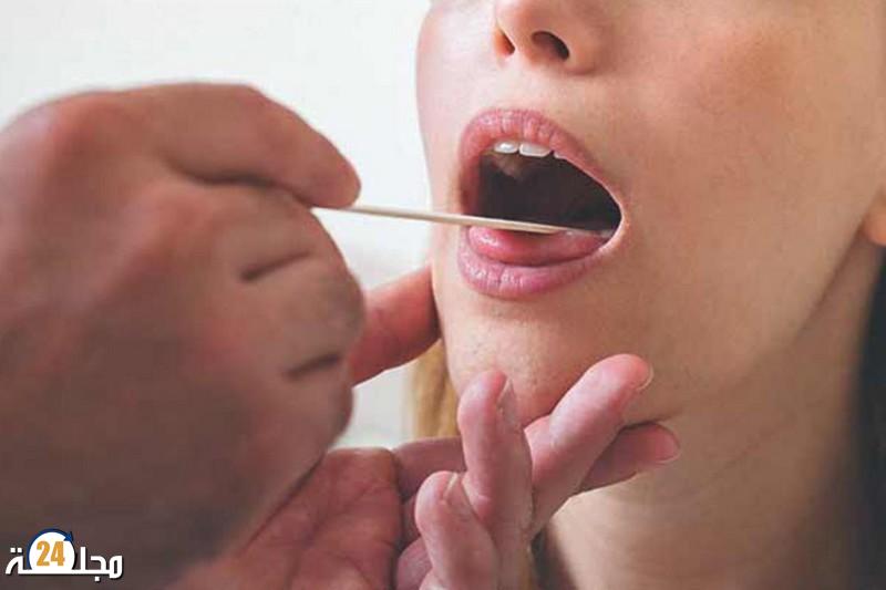 تشخيص السرطان عن طريق التغيرات في اللسان واللثة والخدين