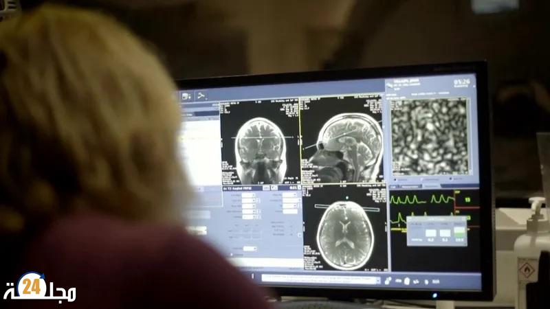 دراسة: كورونا يزيد خطر التعرض لاعتلالات دماغية طويلة الأمد