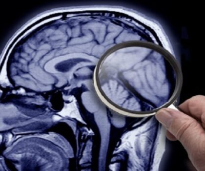 العلماء يكتشفون سببا جديدا لمرض الزهايمر