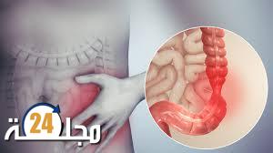 مرض البوليميا: ما هو؟ وما هي أعراضه؟