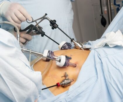 تحذير.. جراحات إنقاص الوزن قد تتسبب بمرض عصبي