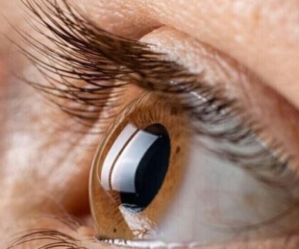 دراسة تربط مرضا يسبب العمى بأمراض القلب والأوعية الدموية