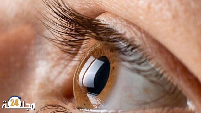 دراسة تربط مرضا يسبب العمى بأمراض القلب والأوعية الدموية