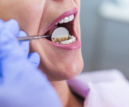 طبيب أسنان يحذر من علامات لسرطان الفم لا يجب تجاهلها