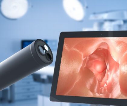 اكتشاف طريقة لتشخيص سرطان القولون والمستقيم في مرحلة مبكرة