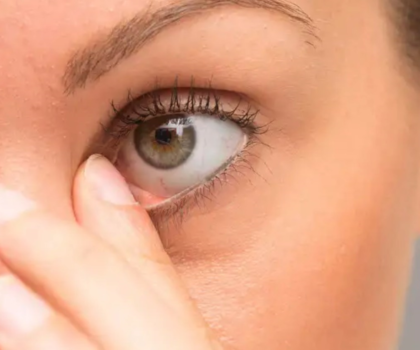 علامة “غريبة” في العين قد تكون مؤشرا لسرطان خطير