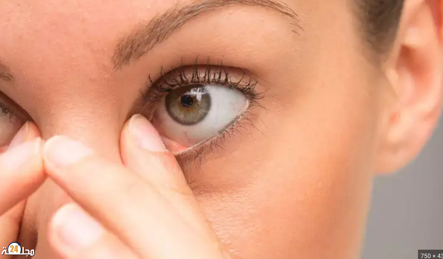 علامة “غريبة” في العين قد تكون مؤشرا لسرطان خطير