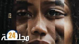 كيف تؤثر العنصرية على الدماغ والجسم؟