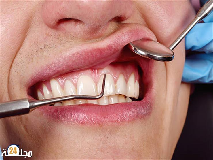 صحة الفم السيئة يمكن أن تؤدي إلى خراجات دماغية قاتلة