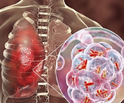 استنفار في ألمانيا بسبب انتشار مرض خطير