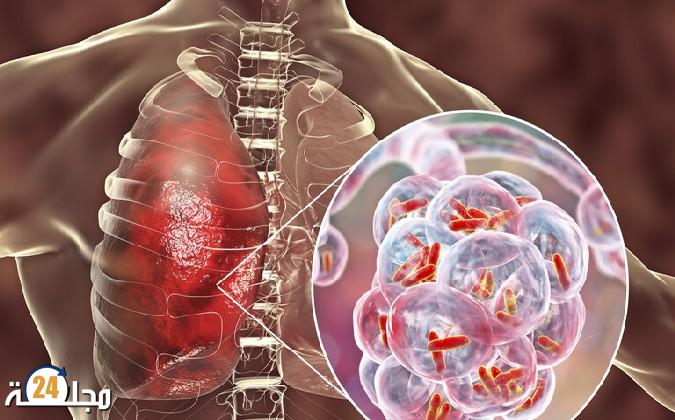 استنفار في ألمانيا بسبب انتشار مرض خطير