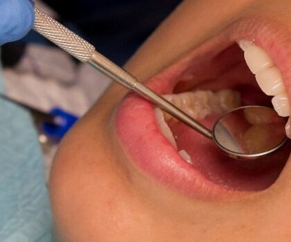 دراسة: صحة الفم السيئة تزيد من خطر الإصابة بفشل القلب والسكتة الدماغية