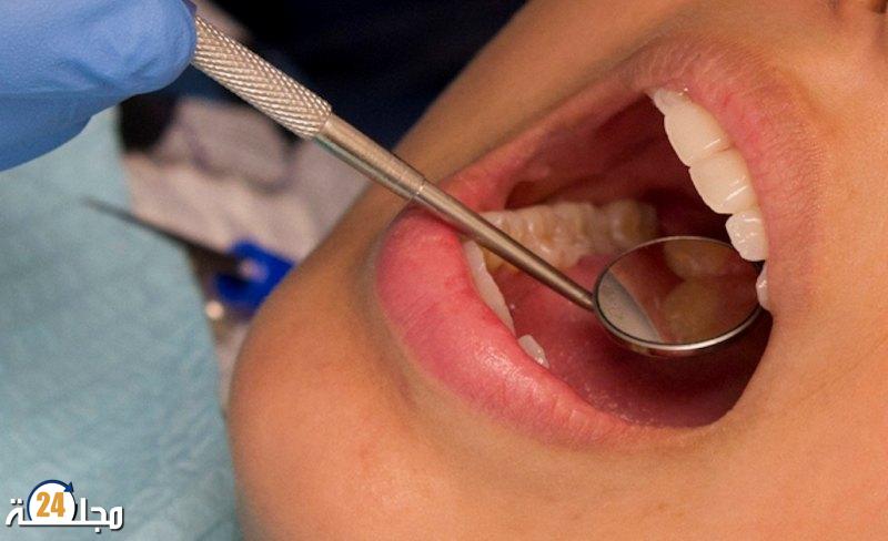 دراسة: صحة الفم السيئة تزيد من خطر الإصابة بفشل القلب والسكتة الدماغية