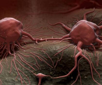 مشروب شائع قد يزيد من خطر إصابتك بالسرطان!